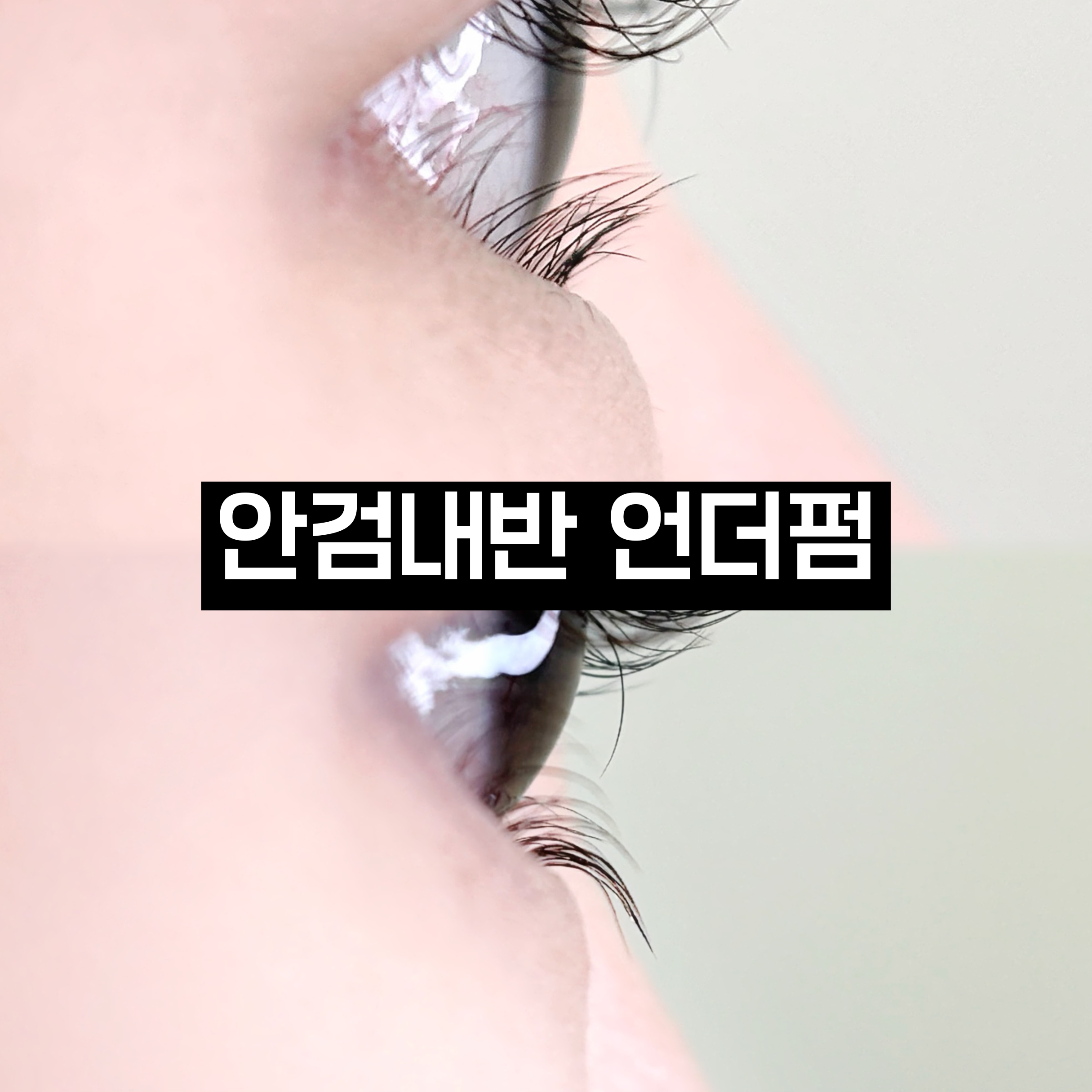 언더펌 시술 결과 2